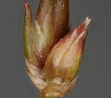 [photo of developing fruit and bulbils]