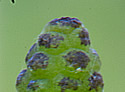 [photo of developing spore cone]