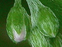 [photo of calyx with appressed hairs]