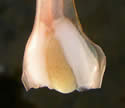 [photo of spore sac]
